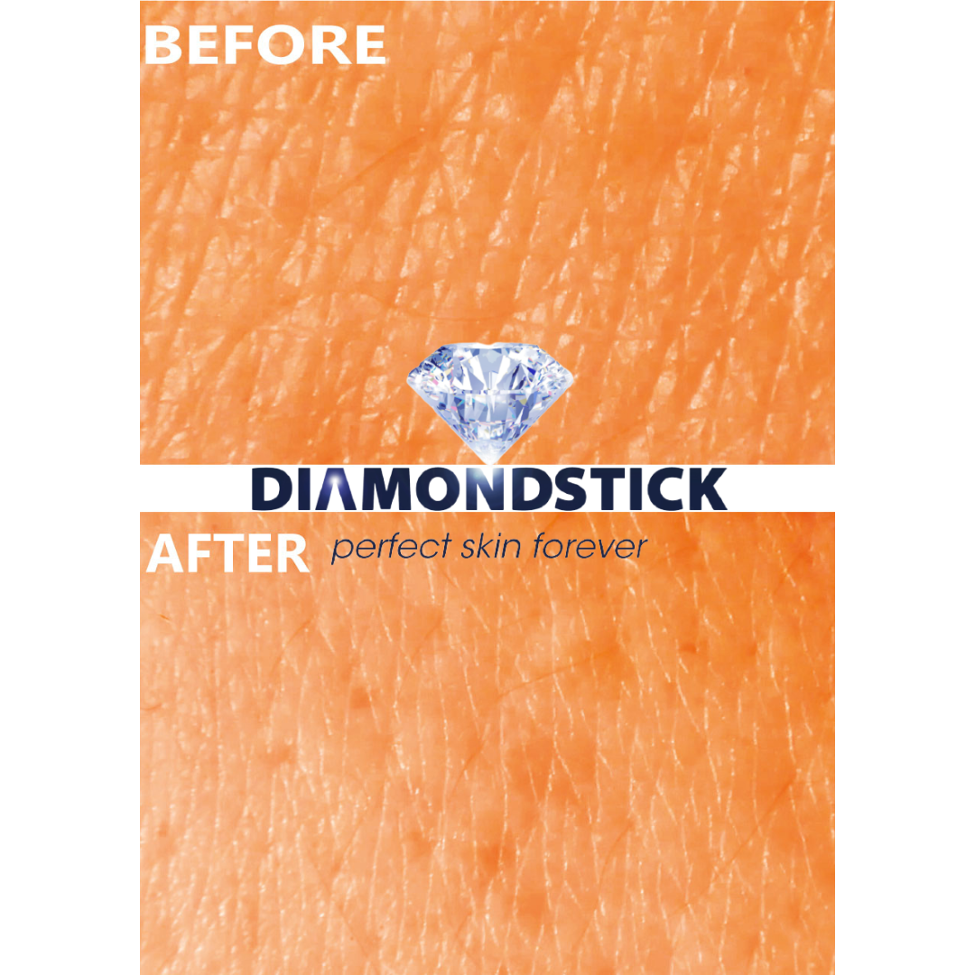 Diamondstick skin before after CNRS Muller